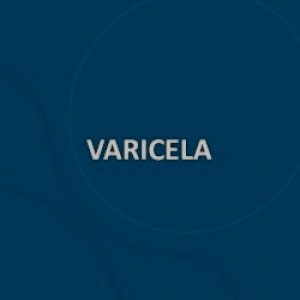 VACINA VARICELA