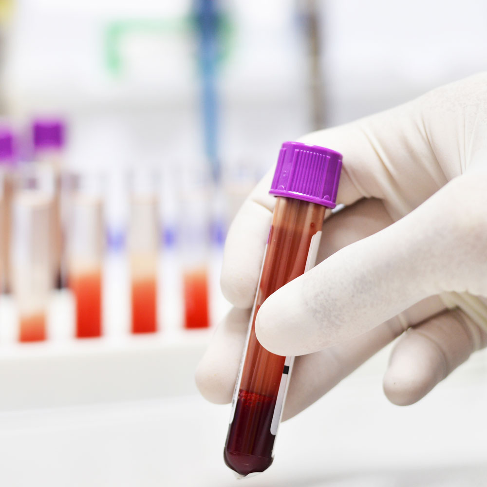 atendimentohumbertoabrao Labclass Hermes Pardini