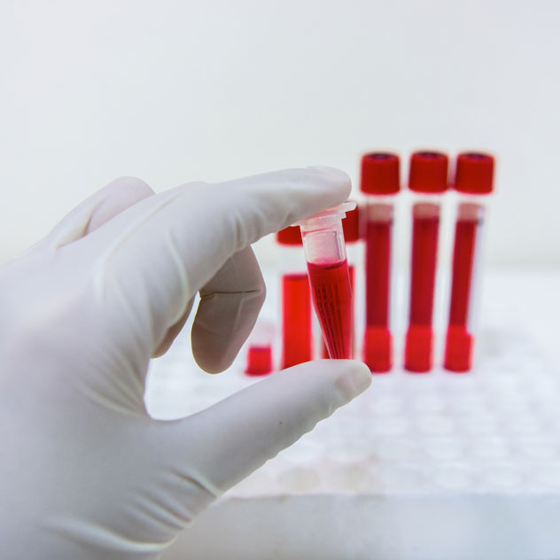 imghistoriasobre Labclass Hermes Pardini