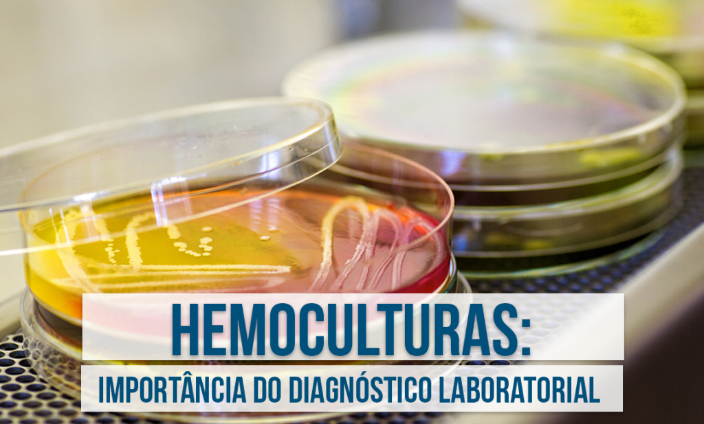 hemocultura Labclass Hermes Pardini